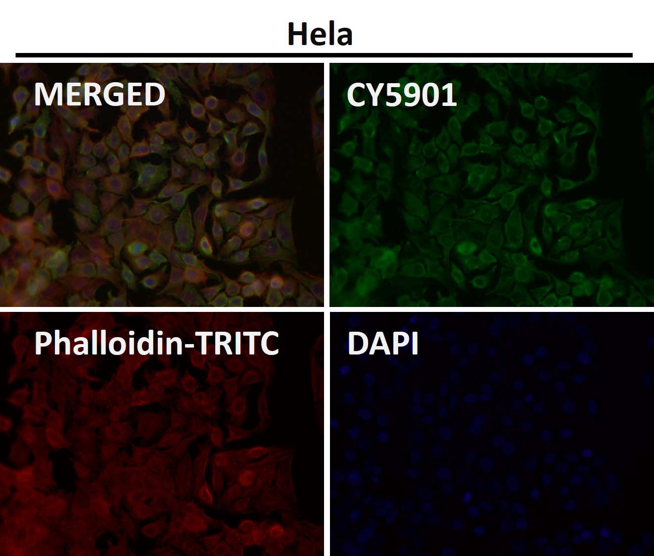 HDAC7 Ab