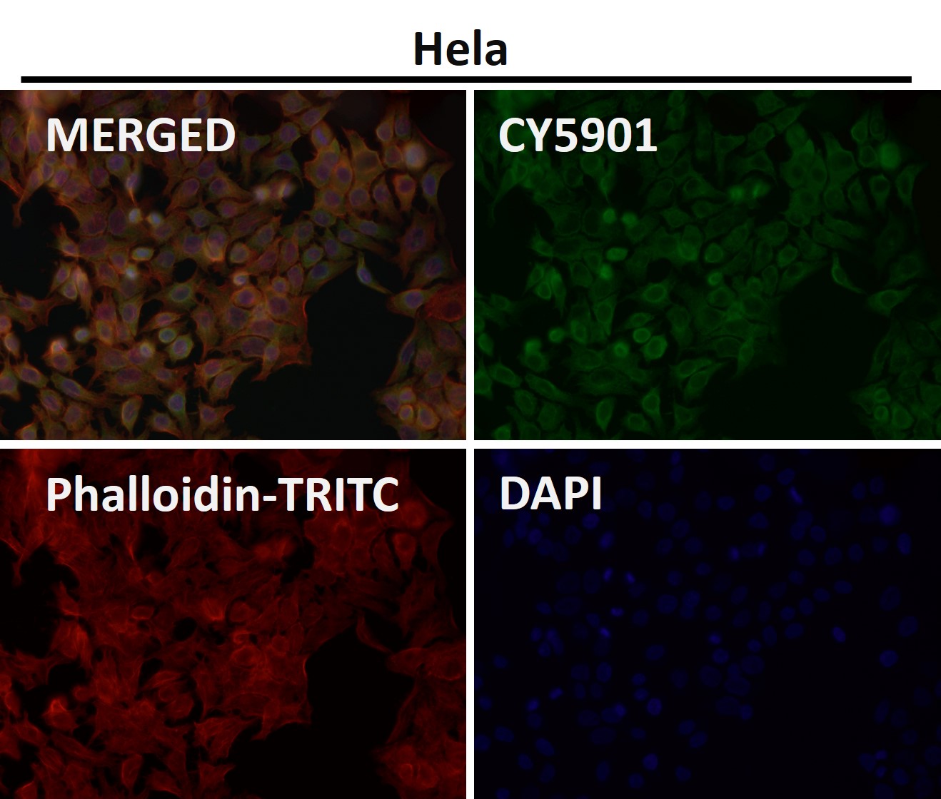 HDAC7 Ab