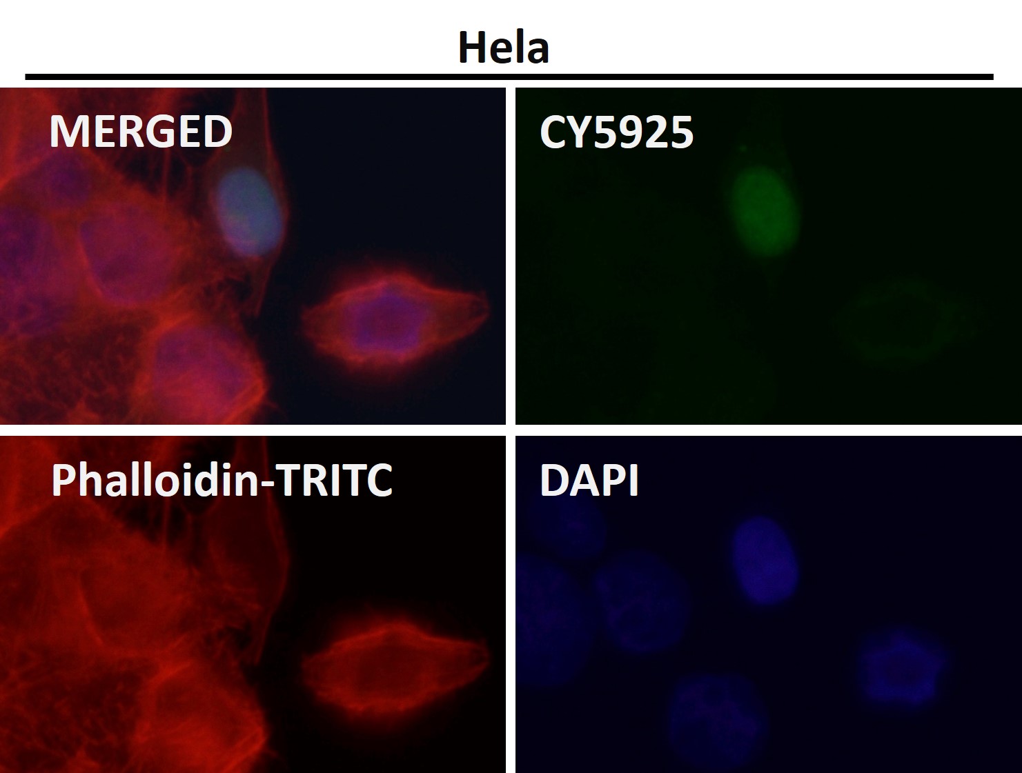 HDAC8 Ab