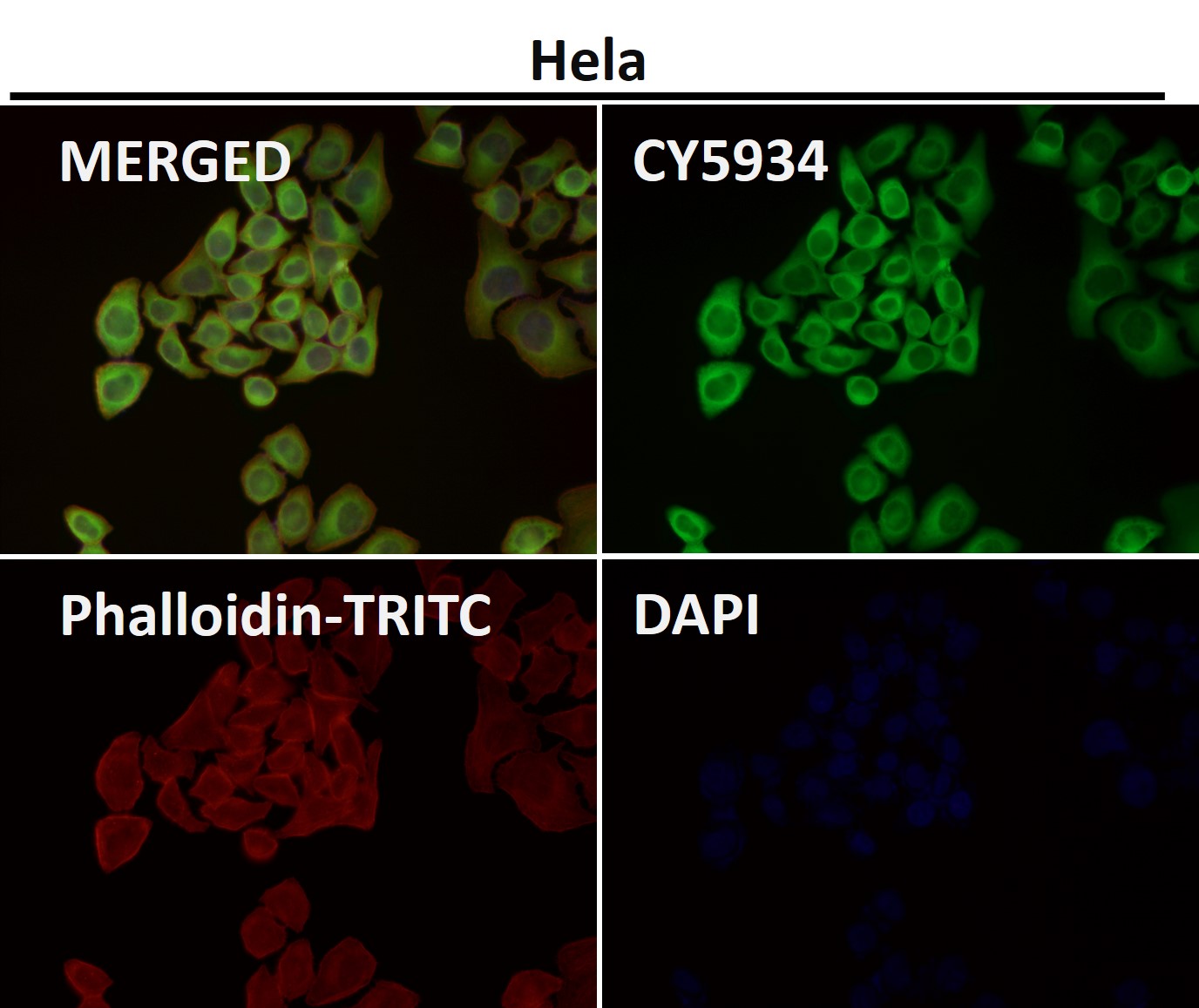 Hsp27 Ab