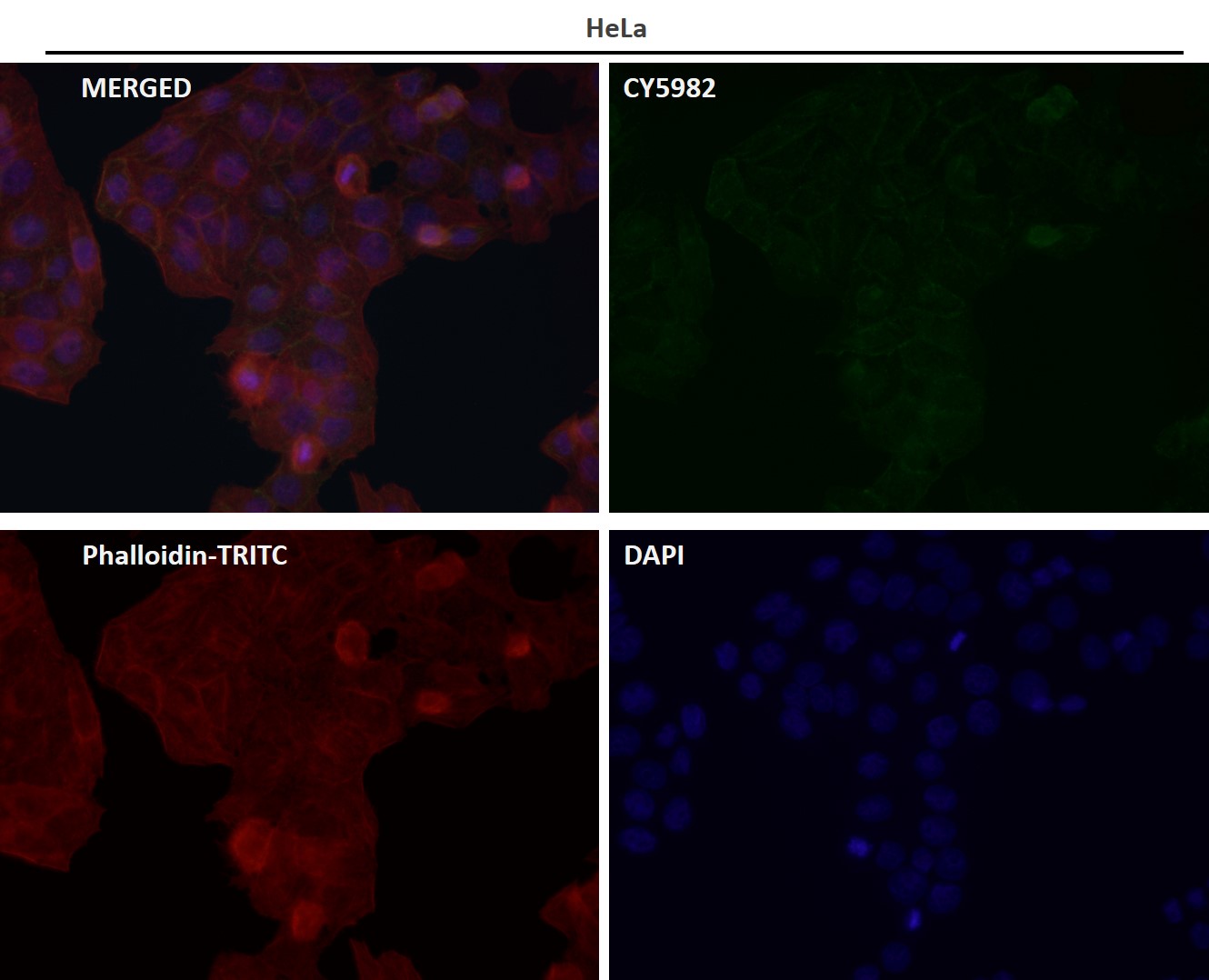 CD3 delta Ab