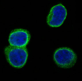 CD3 delta Ab