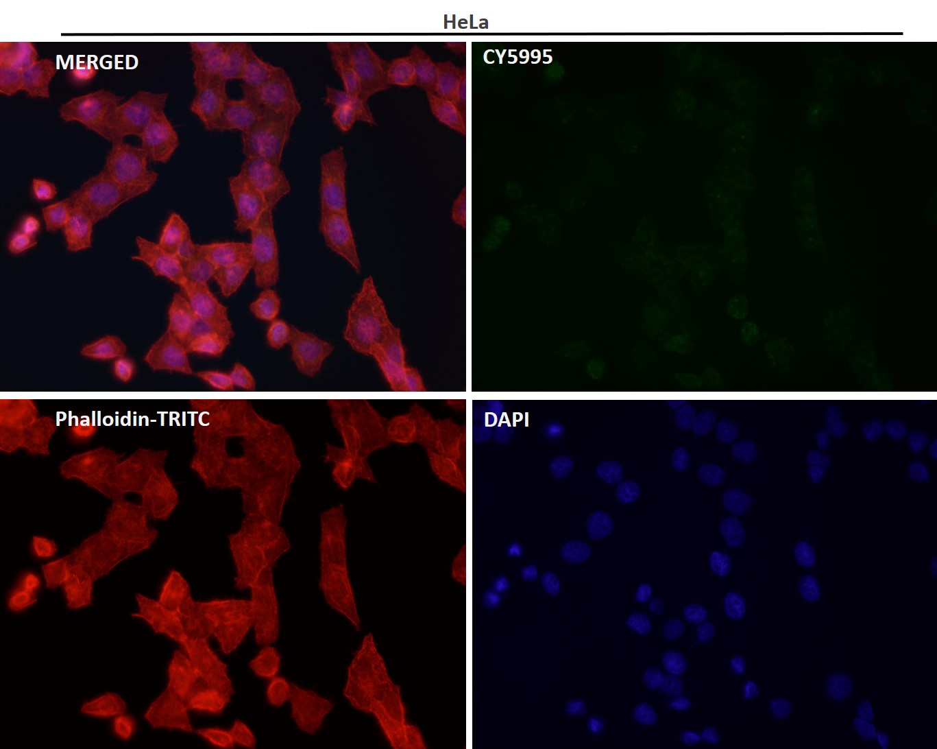 ACSS2 Ab