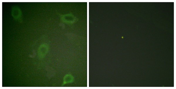 p-Amyloid beta A4 (T743) Ab