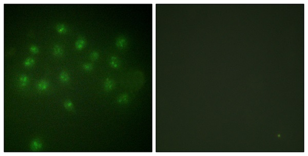 p-Vitamin D3 receptor (S208) Ab