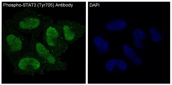 p-STAT3 (Y705) Ab