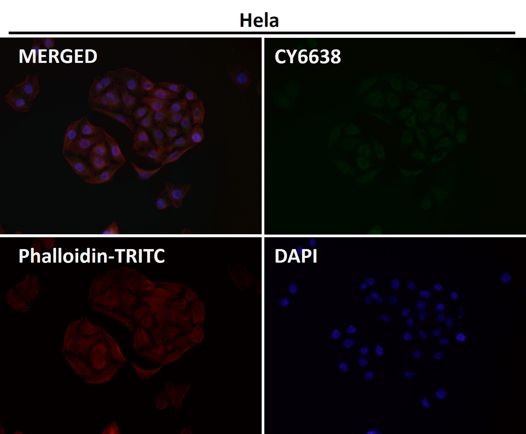 Mitofusin 2 Ab