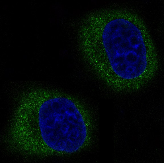 Mitofusin 2 Ab