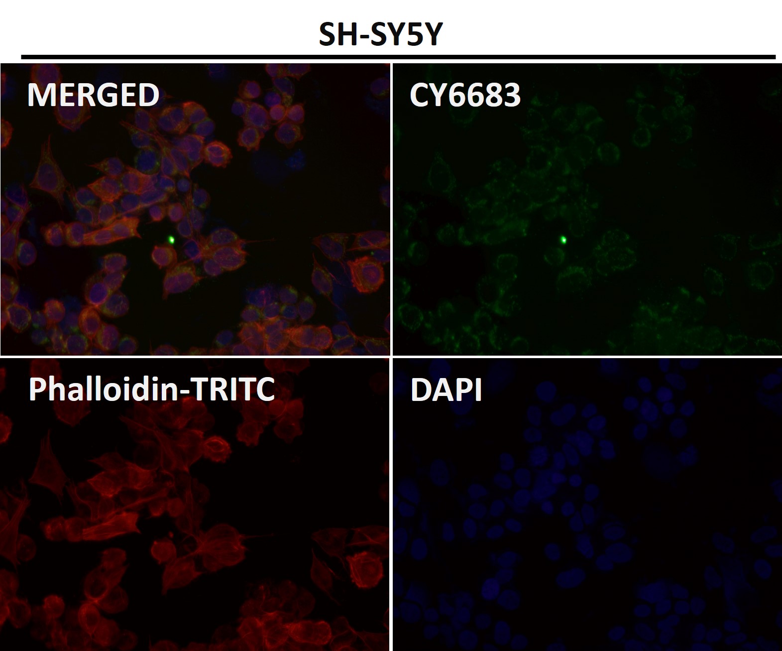 NCAM 1 Ab