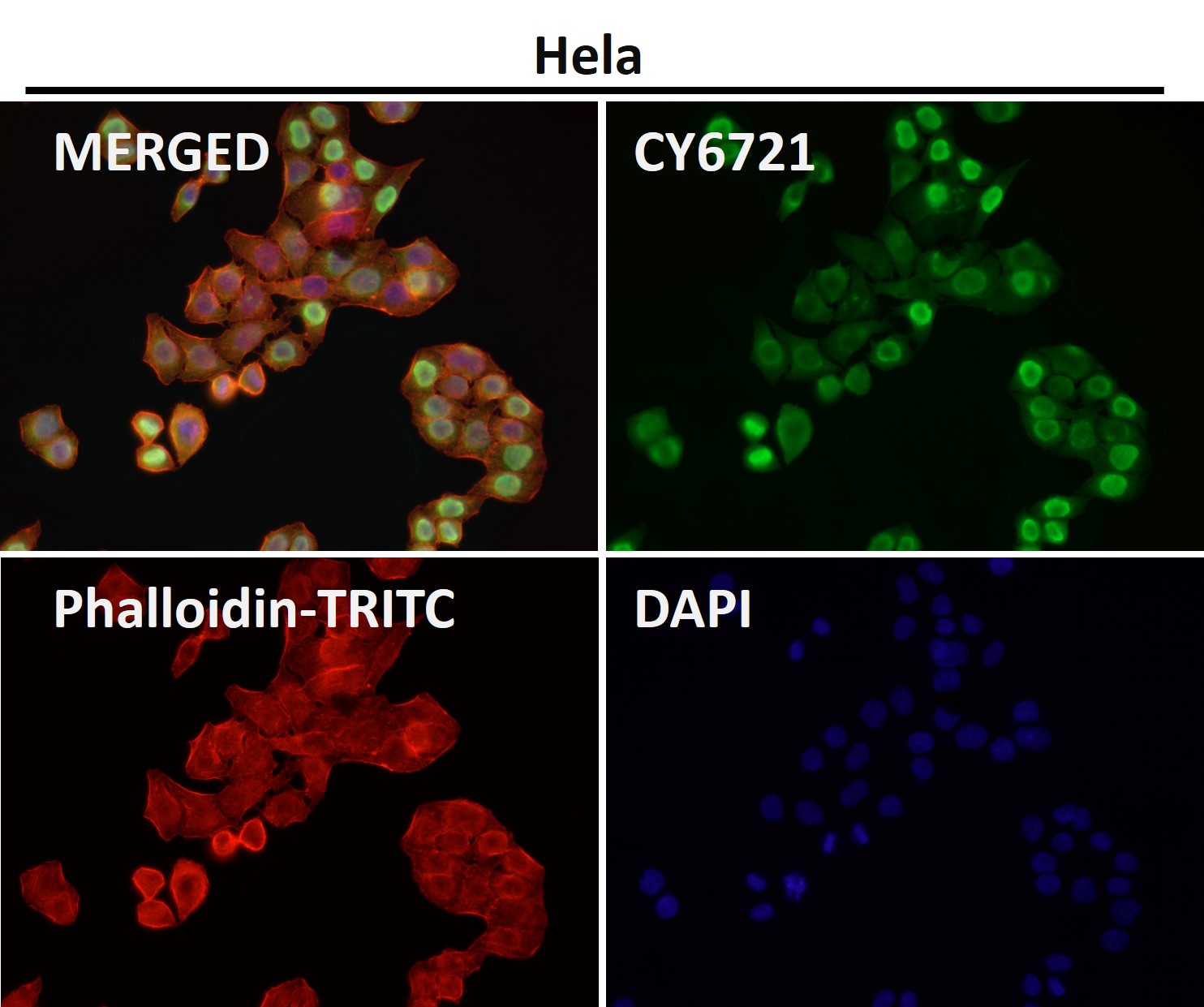 Annexin V Ab