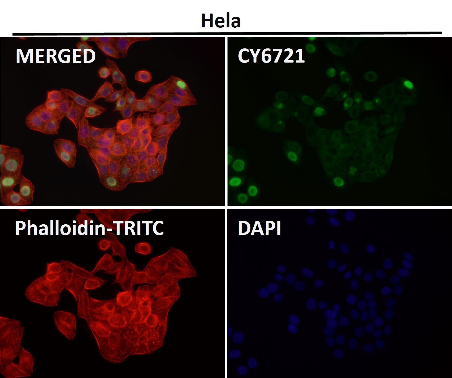 Annexin V Ab