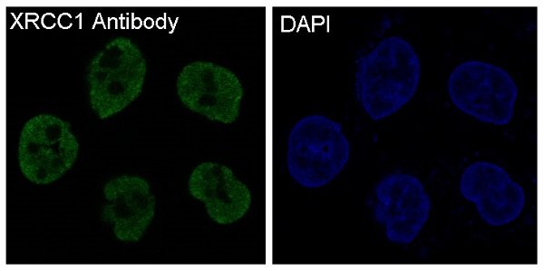 XRCC1 Ab