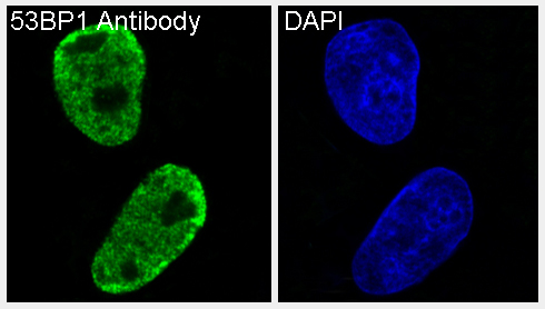 TP53BP1 Ab