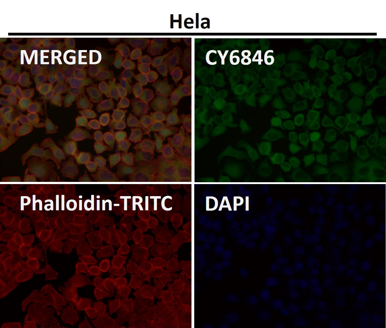 Profilin 1 Ab