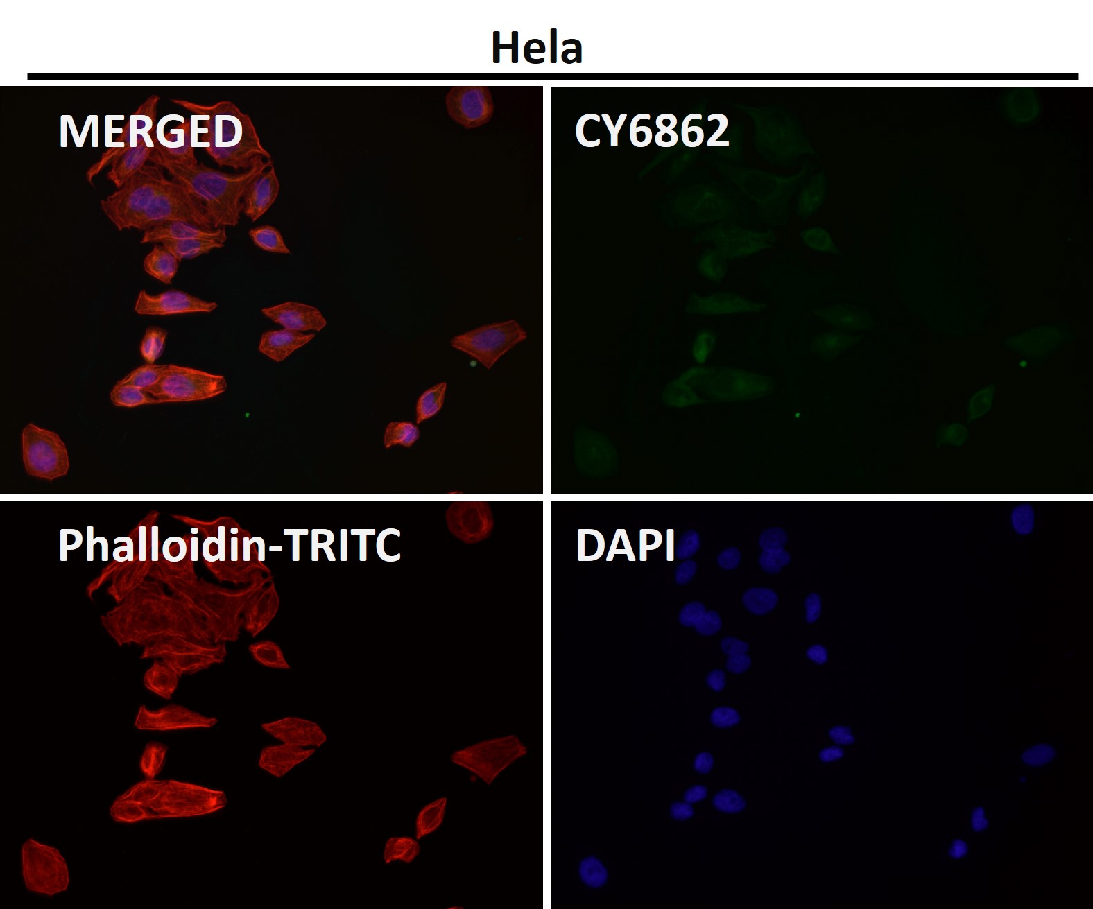 Clathrin heavy chain 1 Ab