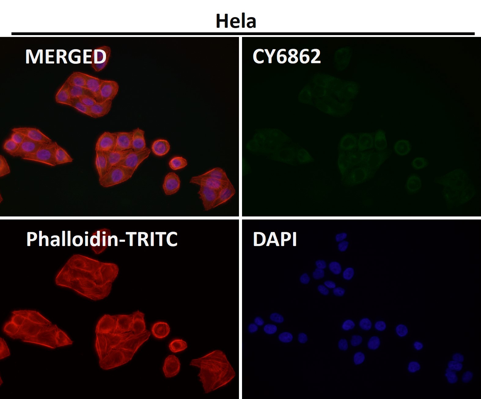 Clathrin heavy chain 1 Ab