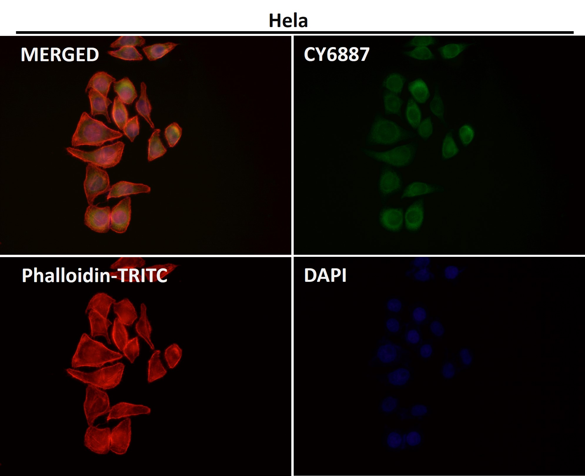 Integrin alpha V Ab