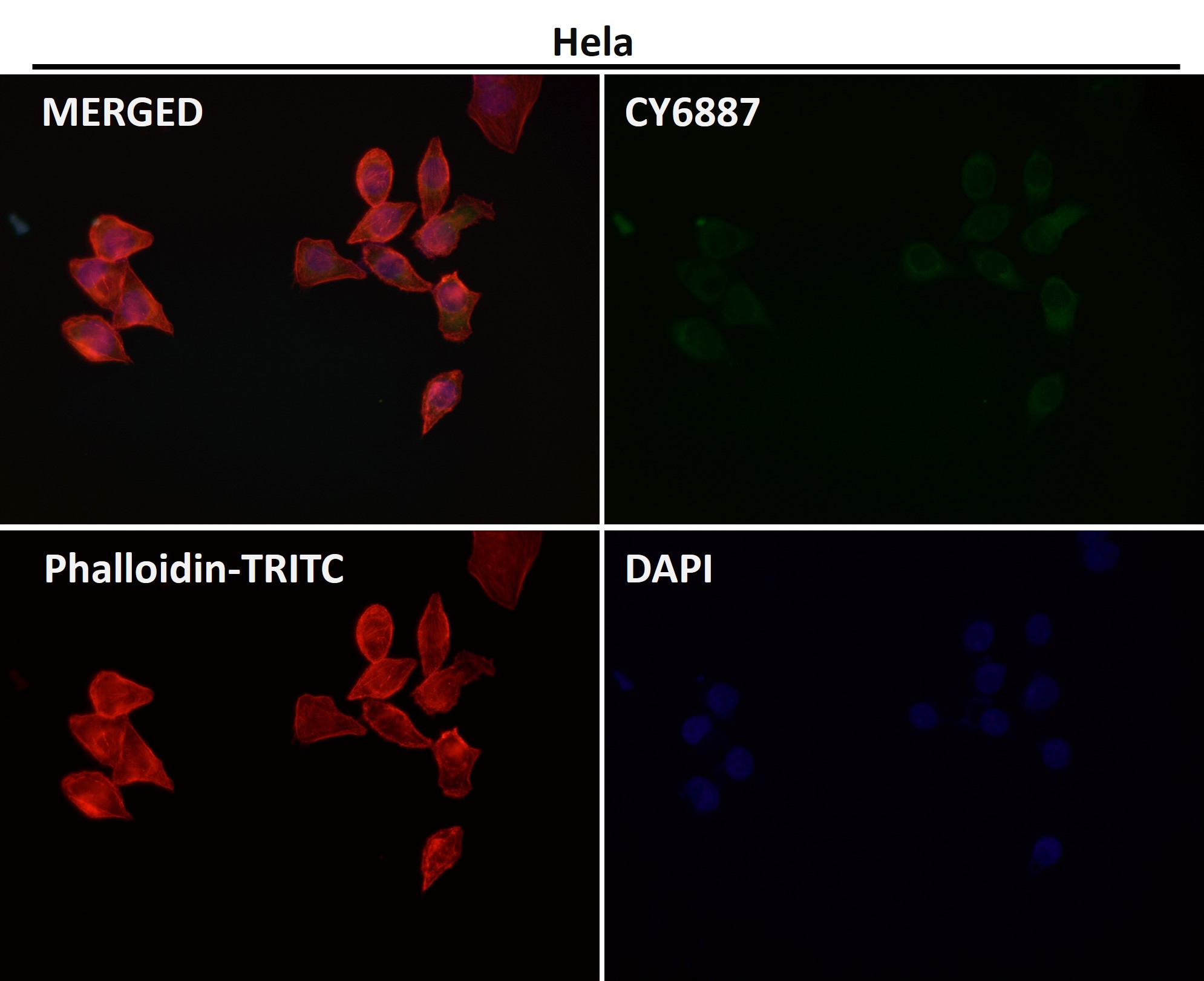 Integrin alpha V Ab