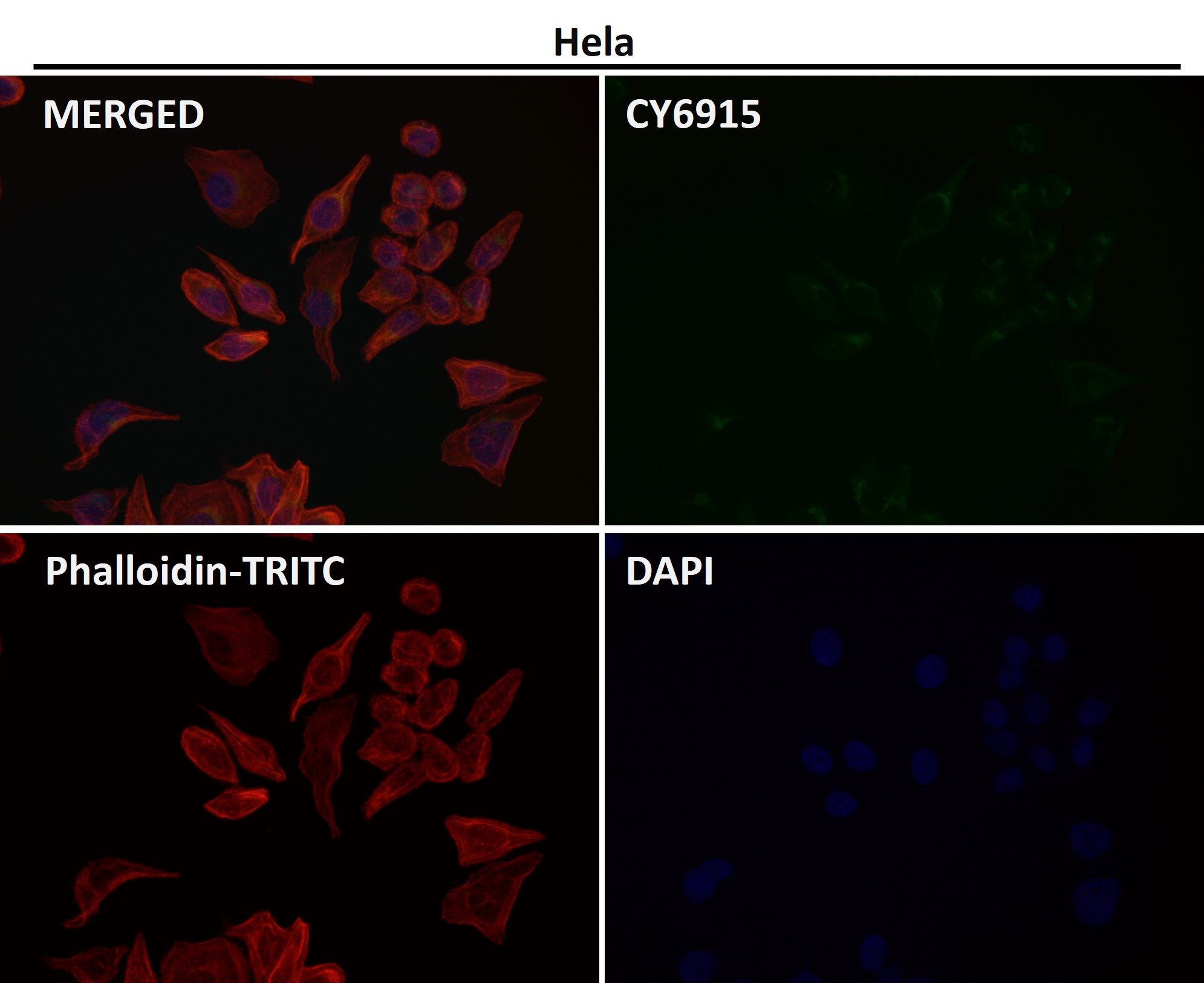 PI3 kinase p85 alpha Ab