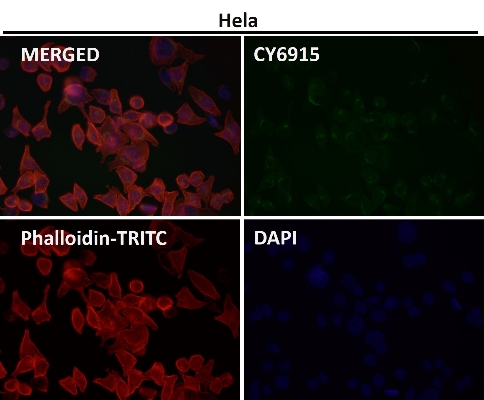 PI3 kinase p85 alpha Ab