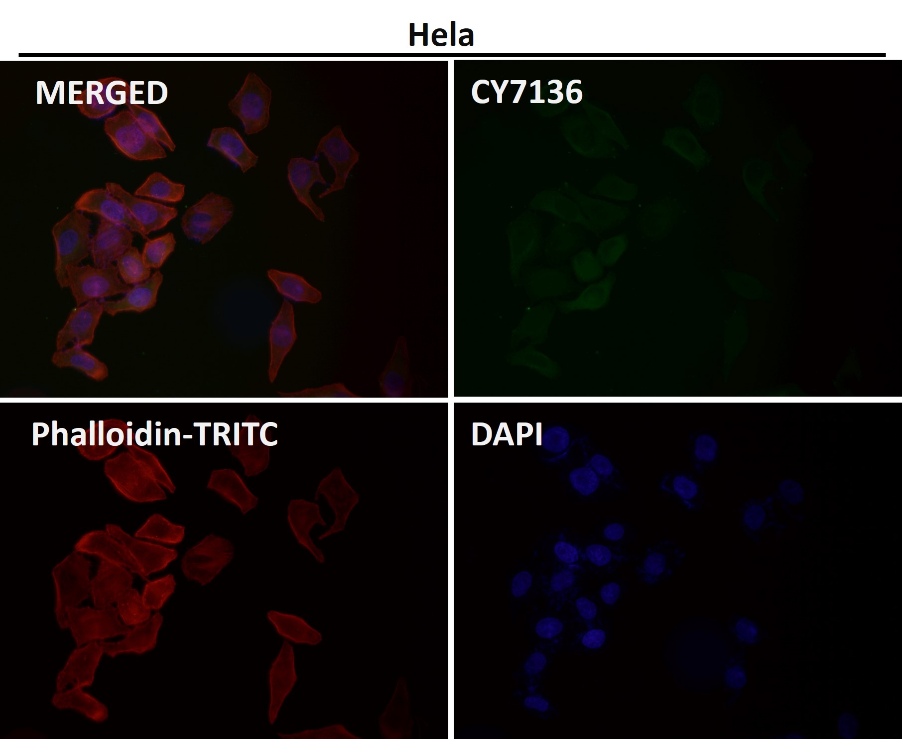 PI3 kinase p110 delta Ab