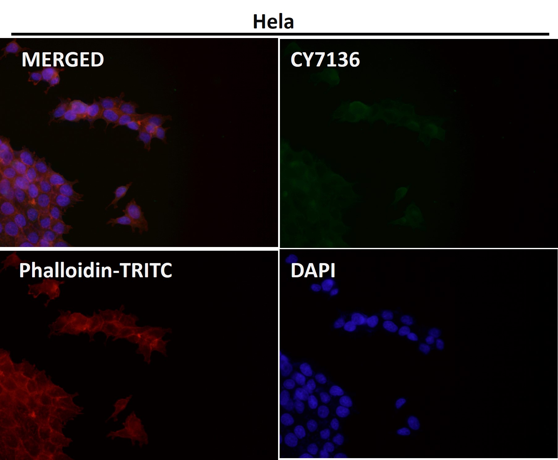 PI3 kinase p110 delta Ab