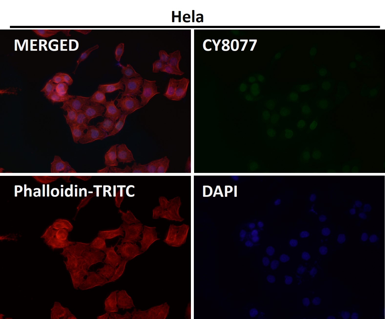 Crotonyl-Histone H2B type 2E (K12) Ab