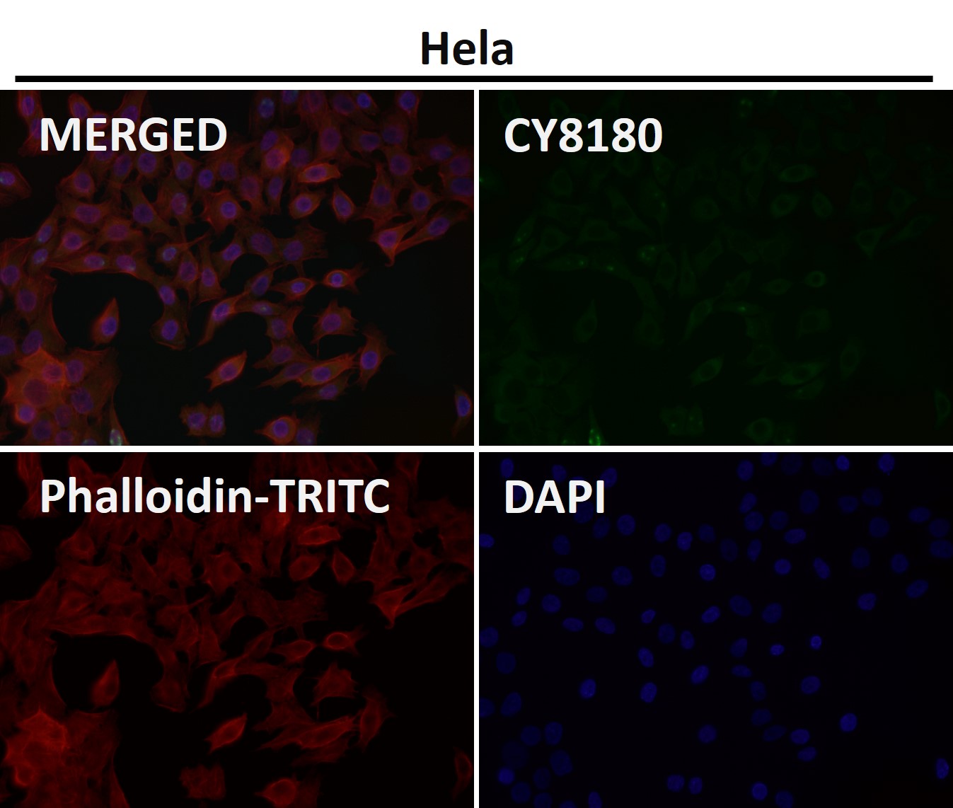 ATP dependent RNA helicase A Ab