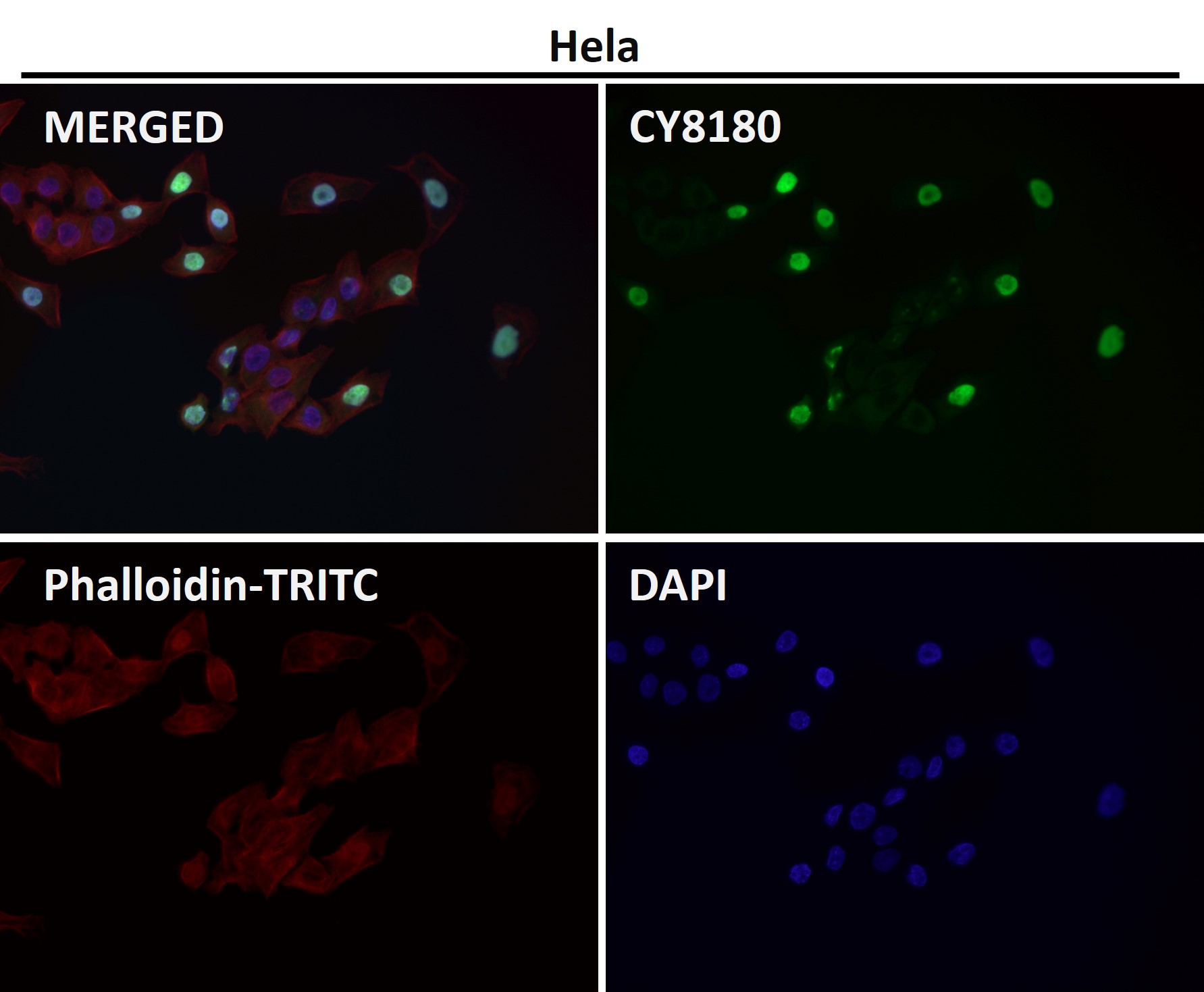 ATP dependent RNA helicase A Ab