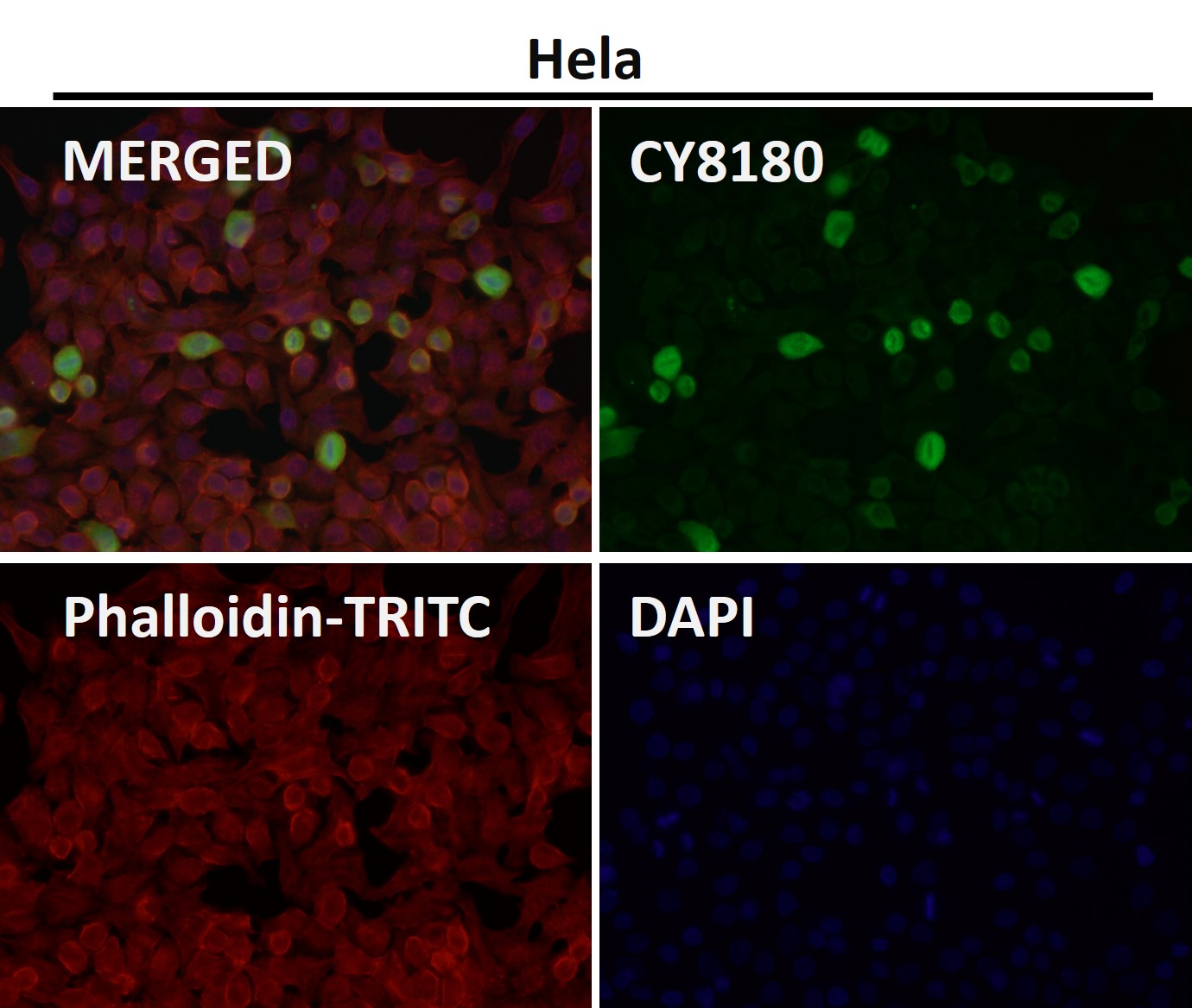 ATP dependent RNA helicase A Ab