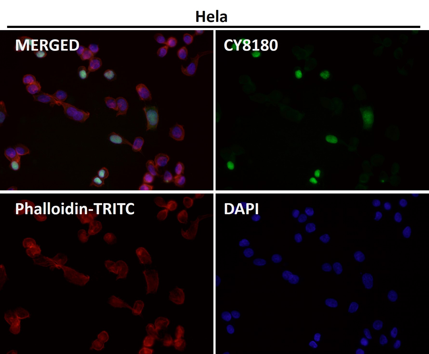 ATP dependent RNA helicase A Ab