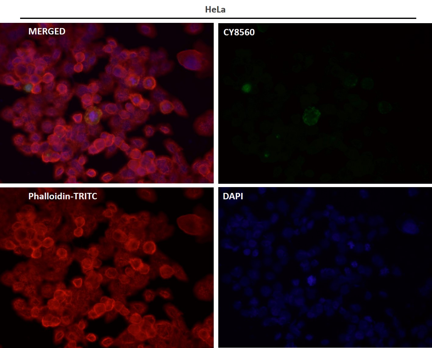 p-Nucleophosmin (S125) Ab