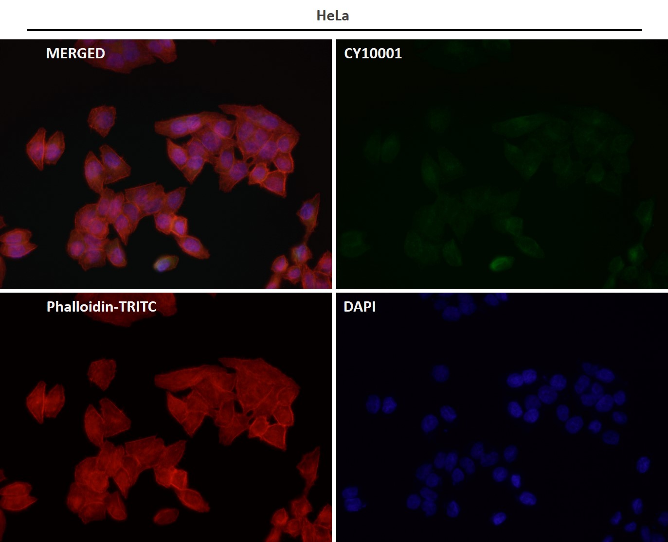 beta Glucuronidase Ab