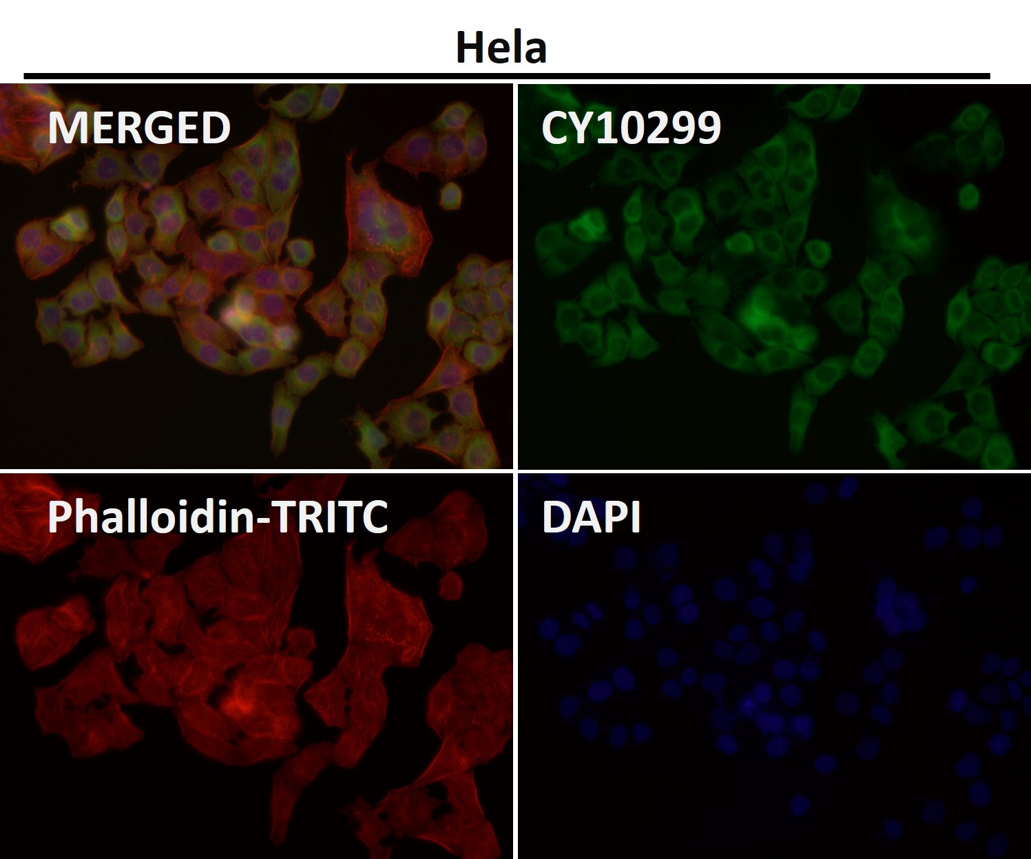 Collagen III alpha 1 Ab