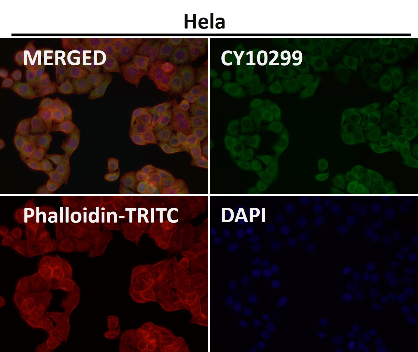 Collagen III alpha 1 Ab