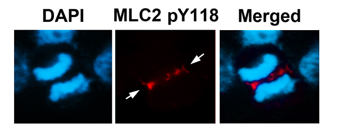 p-Myosin light chain 2 (Y118) Ab