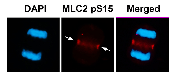 p-Myosin light chain 2 (S15) Ab