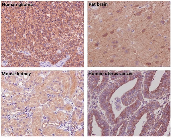 beta Tubulin Ab