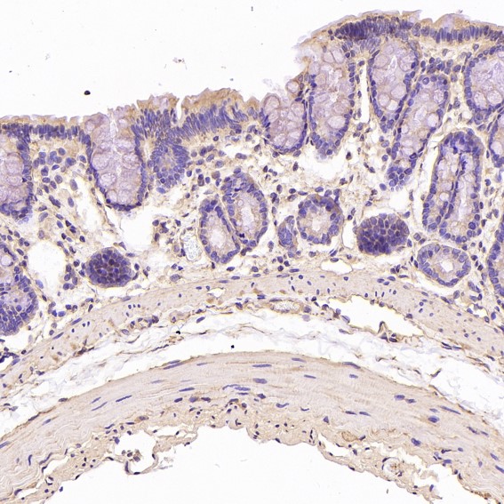 beta Tubulin Ab