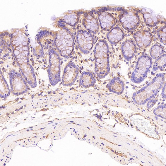 beta Tubulin Ab