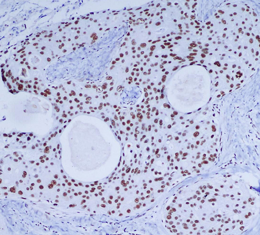 DNA PKcs Ab