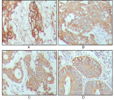 Cytokeratin 18 Ab