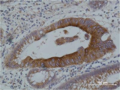 alpha 1B Tubulin Ab