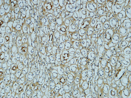 Fibronectin Ab