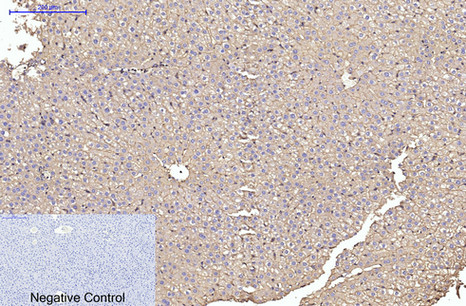 alpha Skeletal muscle actin Ab