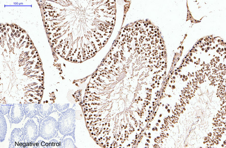 Progesterone receptor Ab