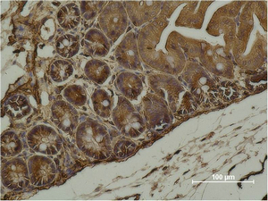 alpha Smooth muscle actin Ab