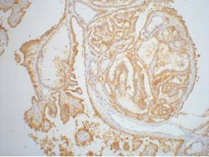 Galectin 3 Ab