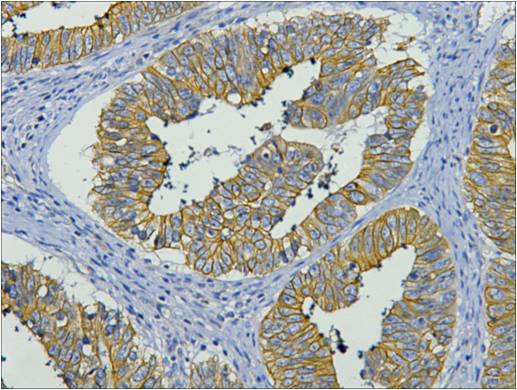 Cytokeratin 19 Ab