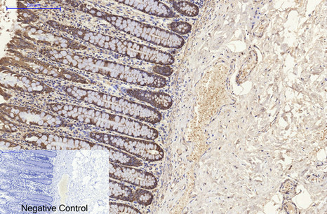 Cytokeratin 8 Ab